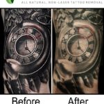 Tattoo Vanish Method Before and After