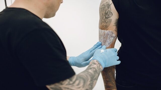 Tattoo Removal — DLS Clinic Limited